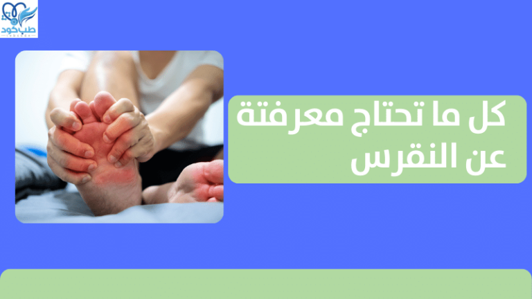 كل ما تحتاج معرفته عن النقرس