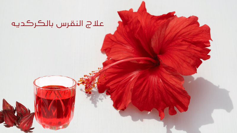 علاج النقرس بالكركديه