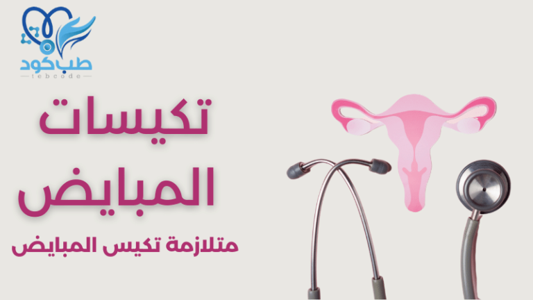 تكيسات المبايض